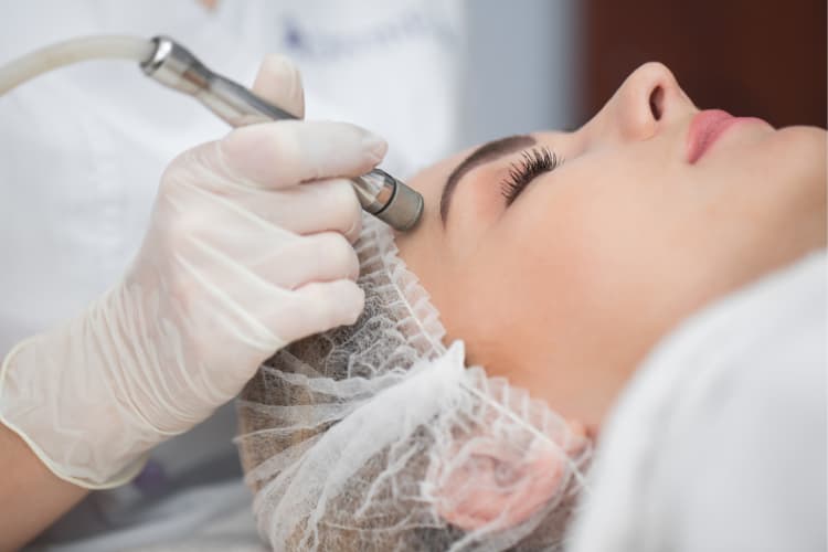 Microdermabrasion