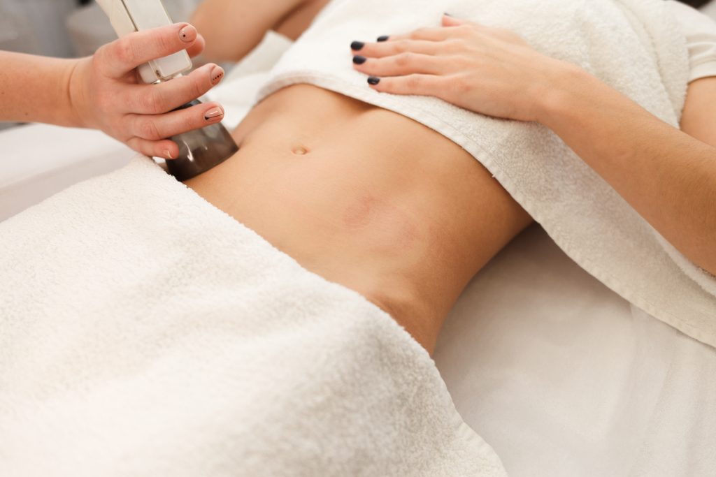 Cryofat freezing