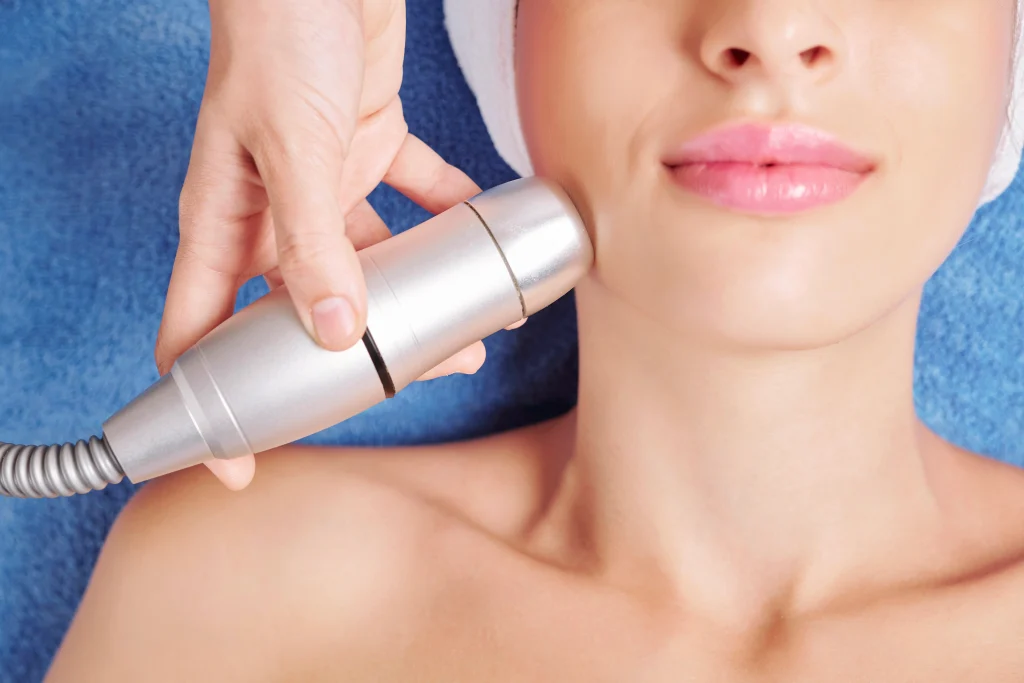 Microdermabrasion nj
