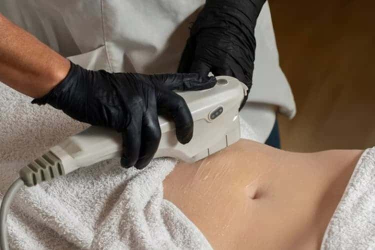 HIFU Body Contouring