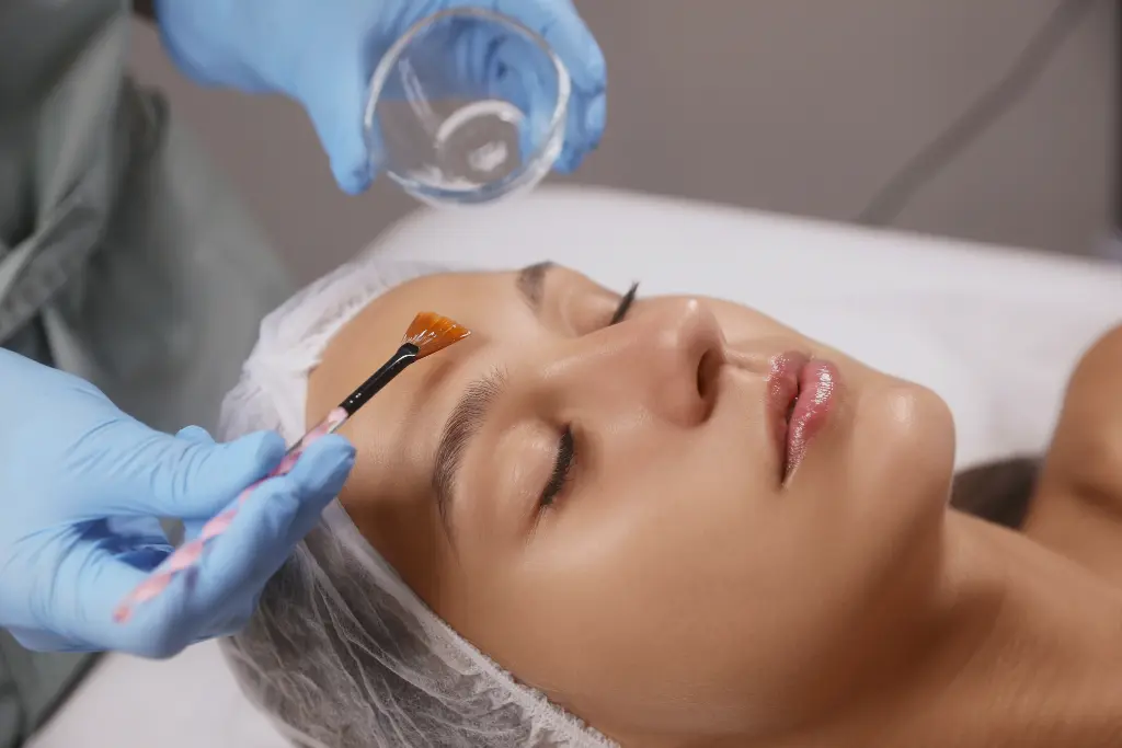 Chemical peel treatment