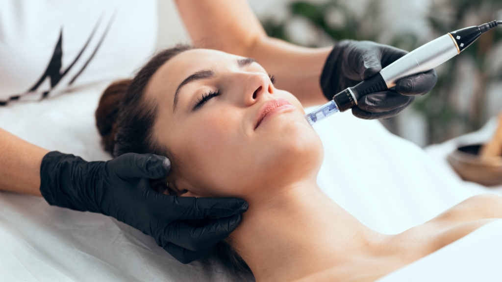Microneedling treatments
