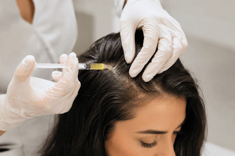Prp hair restoration