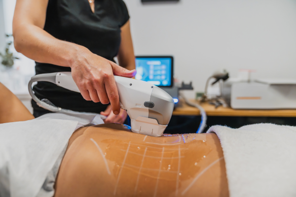 Cryoslim service