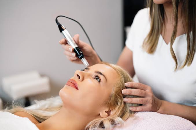 Microneedling under process