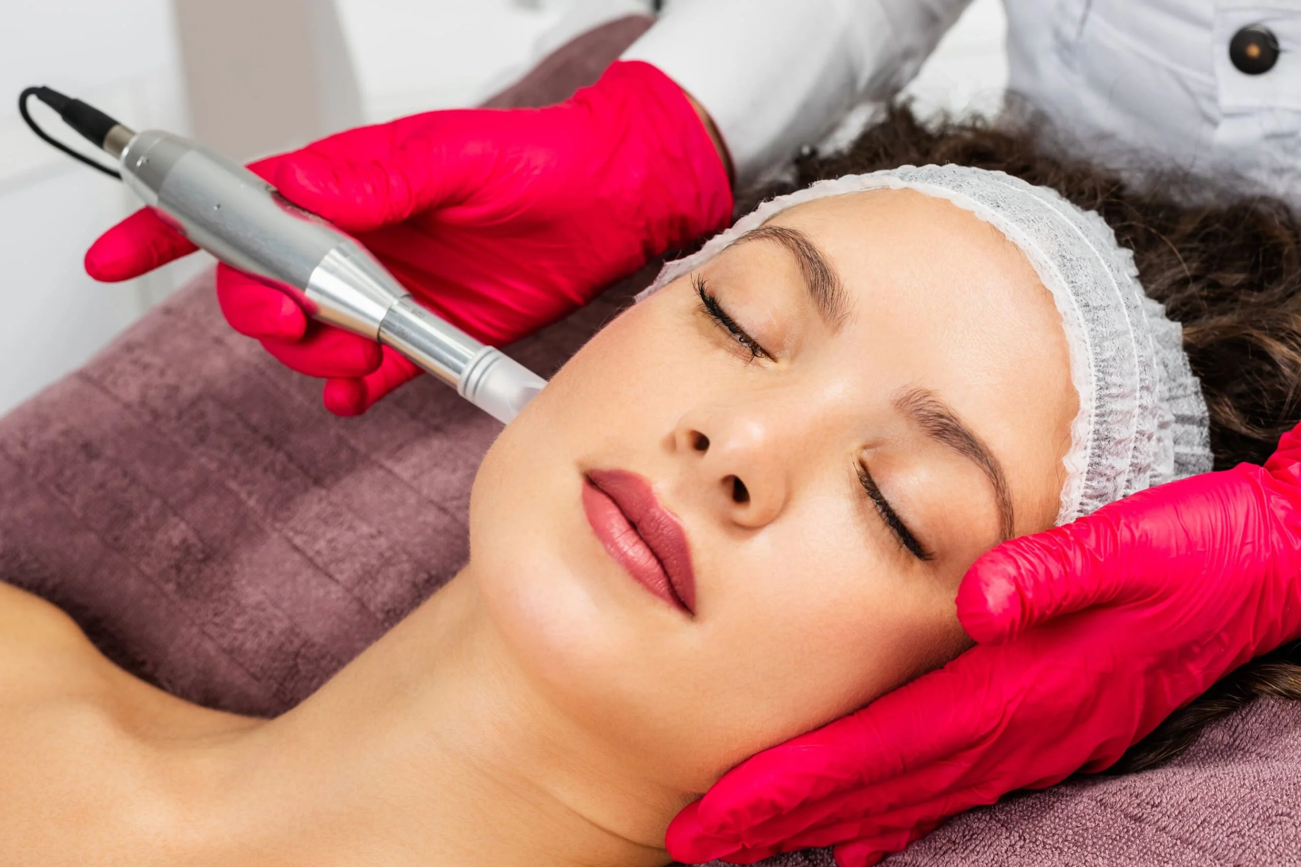 Microneedling process